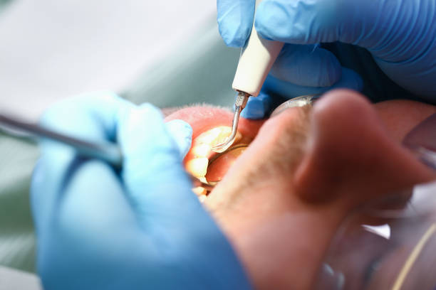 Best Emergency Treatment for Oral Infections in Roebuck, SC