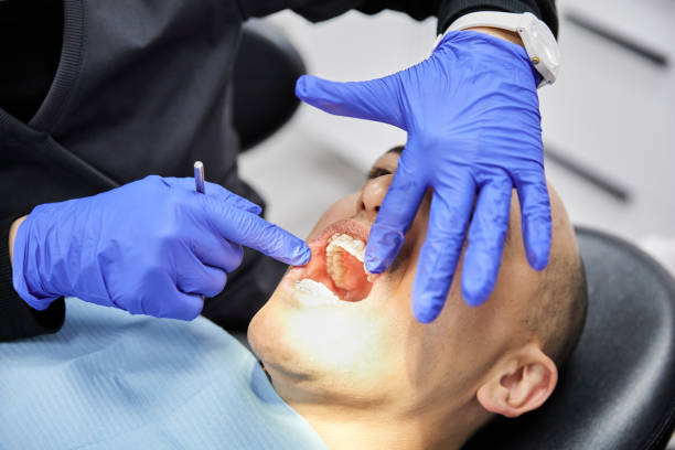 Best Broken or Chipped Tooth Repair in Roebuck, SC